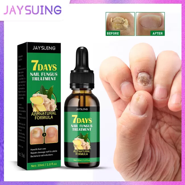 Jaysuing Nail Fungus Treatment Essence Serum