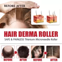 Jaysuing Hair Derma Roller Microneedle Roller